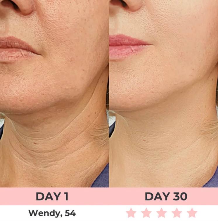 LED Rejuvenator+LIFTING SERUM