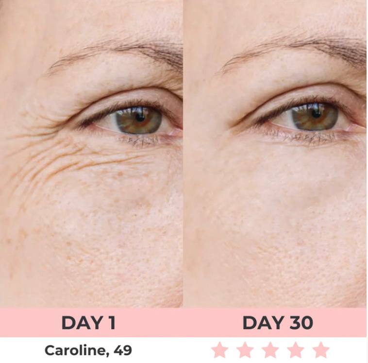 LED Rejuvenator+LIFTING SERUM