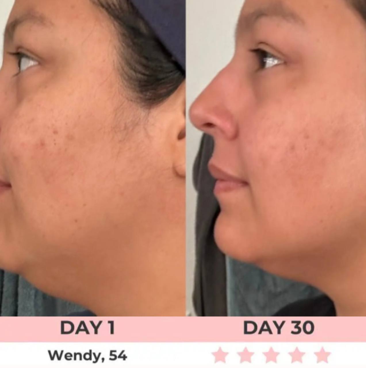LED Rejuvenator+LIFTING SERUM