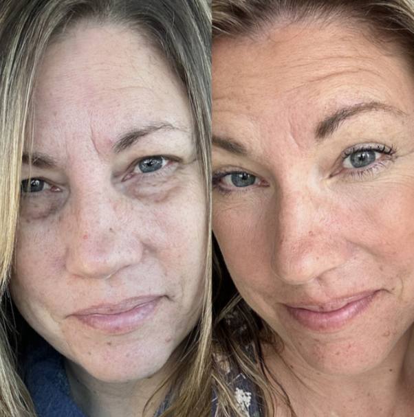 RevitalEyes+ Peptide Eye Cream