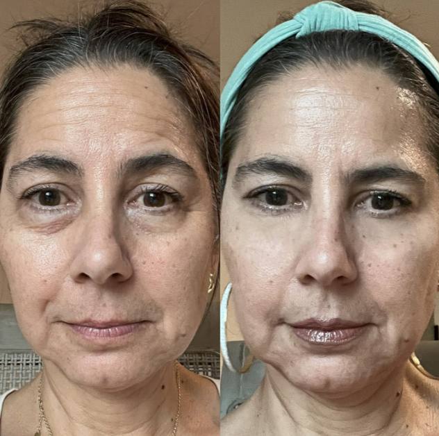 RevitalEyes+ Peptide Eye Cream
