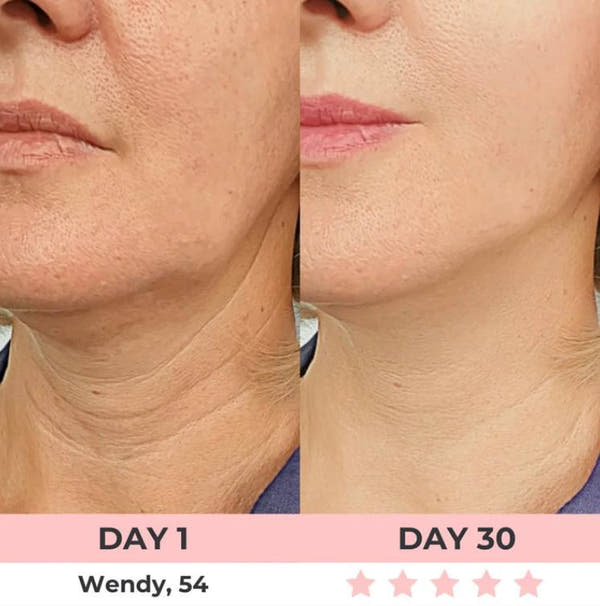 LED Rejuvenator+LIFTING SERUM