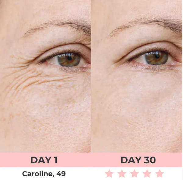 LED Rejuvenator+LIFTING SERUM