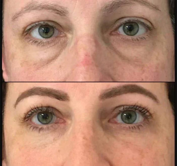Peptide Eye Cream